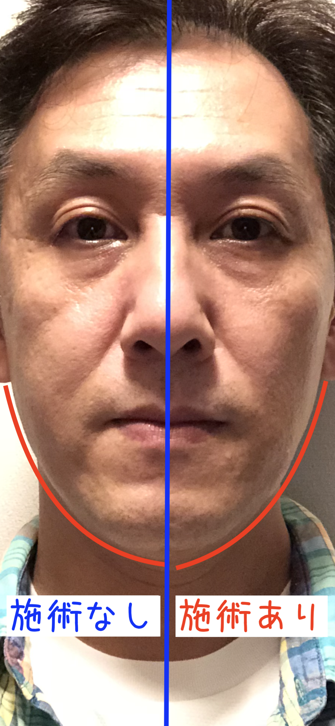 火星人の殺し方 書評 長野市の骨盤矯正と姿勢改善の専門家 伊東稔の公式ブログ カイロプラクティック伊東院長